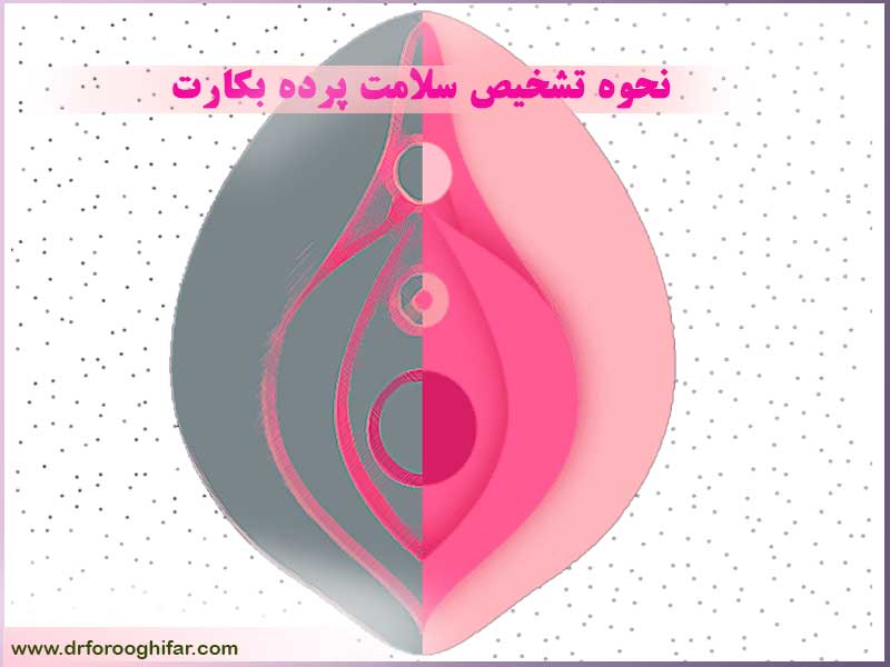 آیا رابطه جنسی بدون خونریزی به معنای پاره نشدن پرده بکارت است